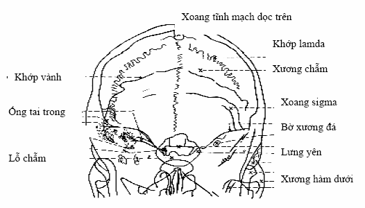 Mốc giải phẫu trên tư thế chụp hố sau (towns).