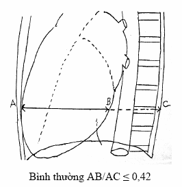 Thất trái to