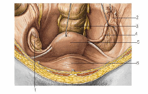 Tử cung trong hố chậu