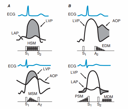 Hình ảnh trên ECG