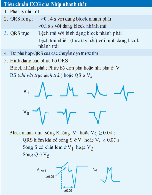 Nhịp nhanh QRS rộng