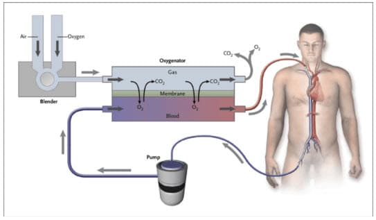 Hình ảnh máy Ecmo