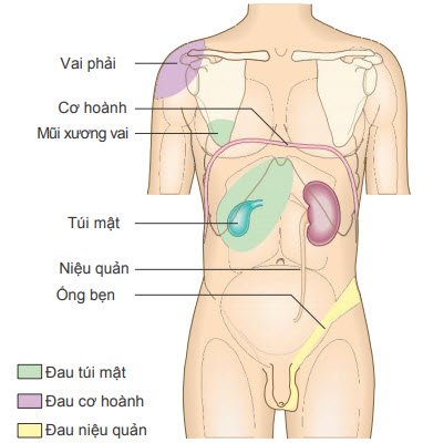 Hướng lan đặc trưng của đau từ túi mật, cơ hoành, niệu quản