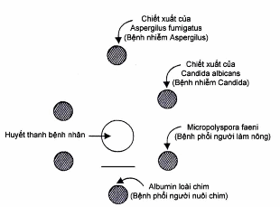 Phát hiện kháng thể kết tủa trong viêm phế nang dị ứng ngoại sinh