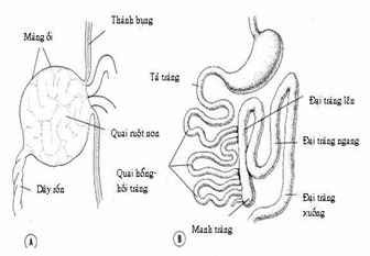 Thoát vị rốn