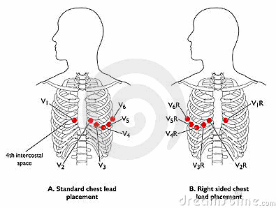 Các chuyển đạo điện tâm đồ