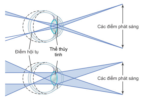Ảnh hưởng của khẩu độ đồng tử nhỏ (trên) và lớn (dưới) đến độ sâu tiêu điểm