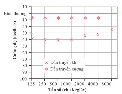 Thính lực đồ của điếc dẫn truyền không khí do xơ cứng tai giữa
