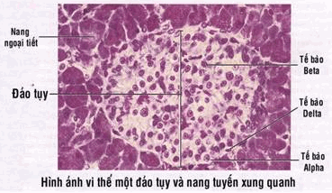 Vi thể một tiểu đảo.