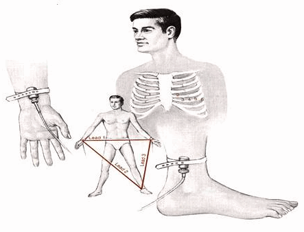 Cách mắc các điện cực trên da để ghi điện tim