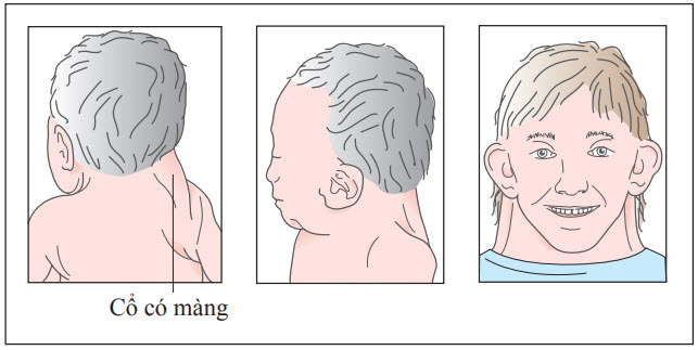 Cổ có màng