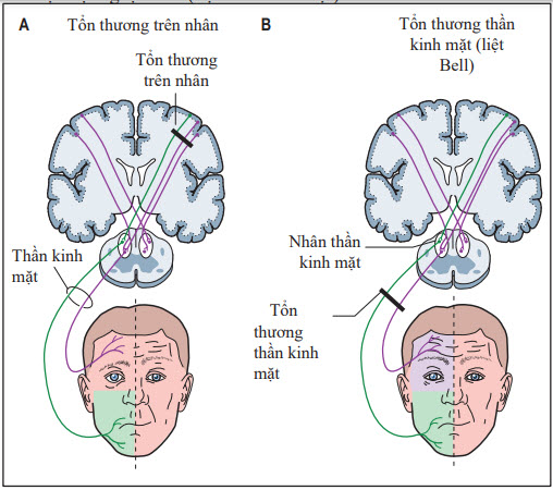 Sơ đồ thể hiện phân bố thần kinh mặt